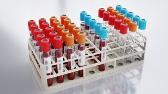 creatinina,-tsh,-alt…-o-que-os-exames-de-sangue-mostram-sobre-as-funcoes-do-organismo?
